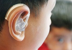 هنجاریابی و بررسی ویژگیهای روانسنجی مقیاس های بالینی عملکرد حرکتی در کم شنوایان